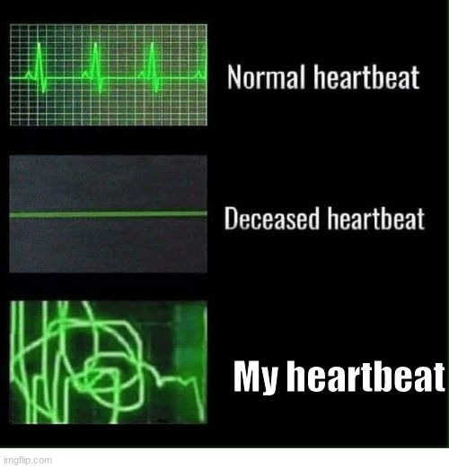 Laziness | My heartbeat | image tagged in normal heartbeat deceased heartbeat,laziness | made w/ Imgflip meme maker