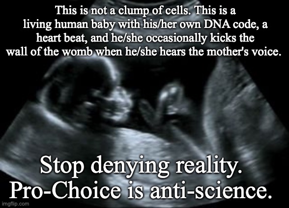 This is not a clump of cells. This is a living human baby with his/her own DNA code, a heart beat, and he/she occasionally kicks the wall of the womb when he/she hears the mother's voice. Stop denying reality. 
Pro-Choice is anti-science. | image tagged in abortion is murder,pro life,science | made w/ Imgflip meme maker