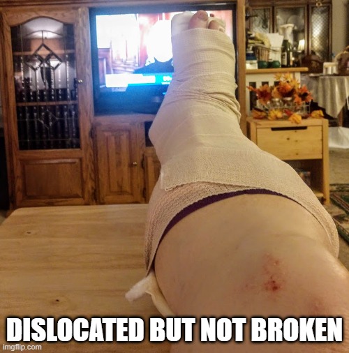 Injured 2020 | DISLOCATED BUT NOT BROKEN | image tagged in injured 2020 | made w/ Imgflip meme maker