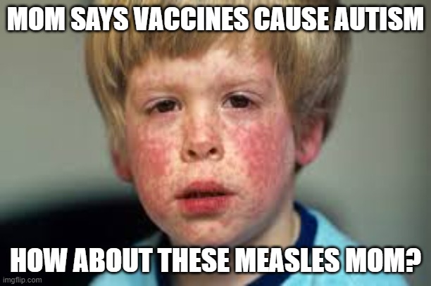 vaccines are safe | MOM SAYS VACCINES CAUSE AUTISM; HOW ABOUT THESE MEASLES MOM? | image tagged in vaccines,vaccination | made w/ Imgflip meme maker