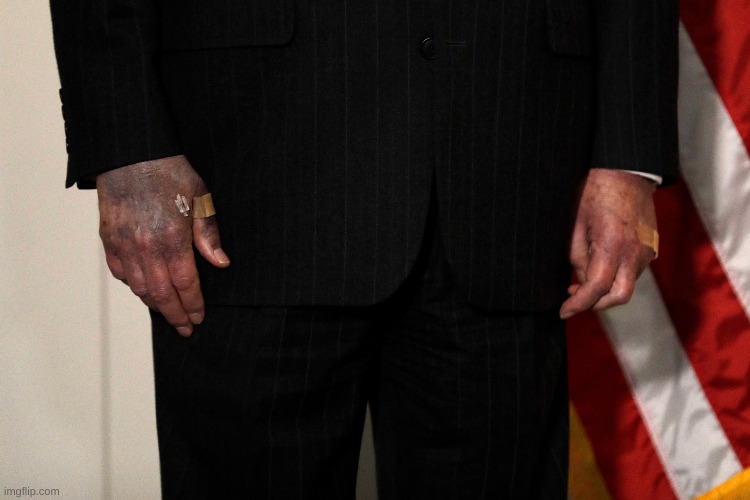 Mitch McConnell’s Hands | image tagged in mitch mcconnell s hands | made w/ Imgflip meme maker