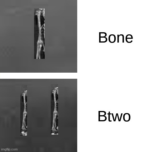 BoneBtwo | Bone; Btwo | image tagged in funny memes,funny,bones | made w/ Imgflip meme maker