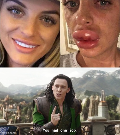 Plastic surgery gone wrong | image tagged in you had one job just the one,plastic surgery | made w/ Imgflip meme maker