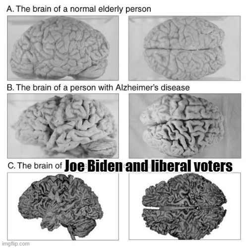 You have to believe in science. | Joe Biden and liberal voters | image tagged in brains,biden,liberals | made w/ Imgflip meme maker