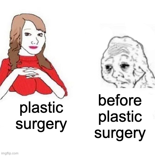 i- | before plastic surgery; plastic surgery | image tagged in plastic surgery,ugly | made w/ Imgflip meme maker