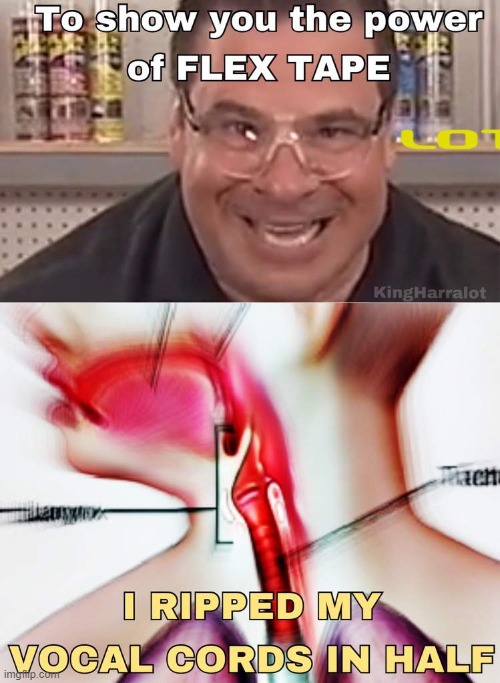 Flex Tape FIXES EVERYTHING!! | image tagged in flex tape,funny memes | made w/ Imgflip meme maker