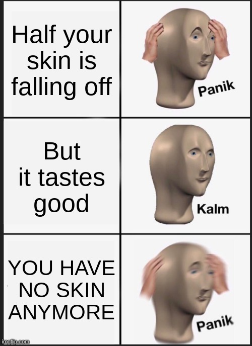 Panik Kalm Panik Meme | Half your skin is falling off; But it tastes good; YOU HAVE
NO SKIN
ANYMORE | image tagged in memes,panik kalm panik | made w/ Imgflip meme maker