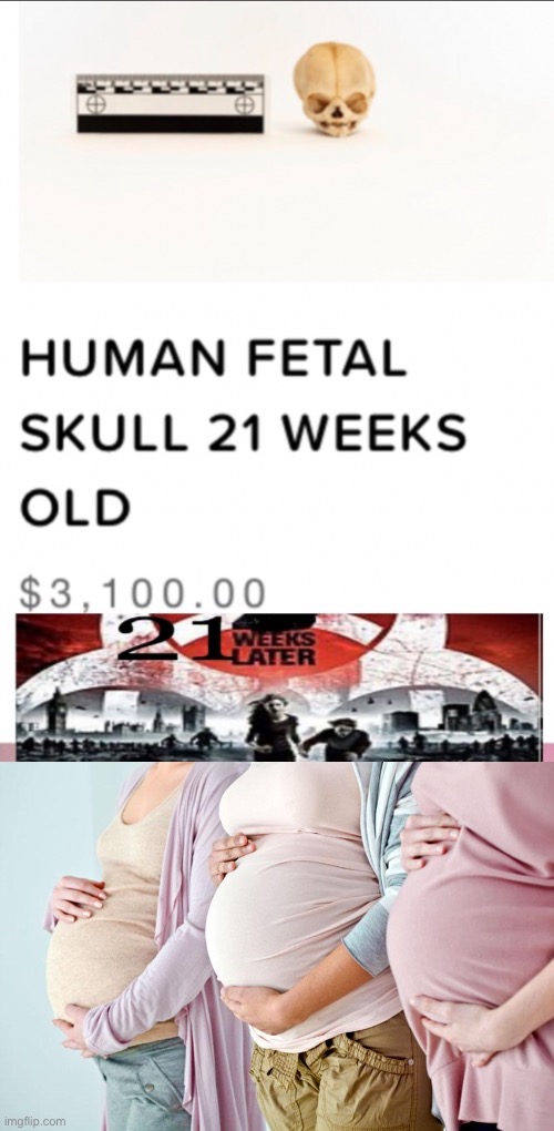 ...recruit a harem, find a late term abortion doctor, and we're in business | image tagged in pregnant side,reposting my own,abortion,fetus,sale | made w/ Imgflip meme maker