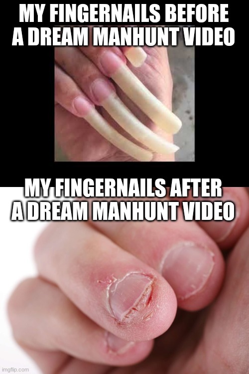 This is the truth | MY FINGERNAILS BEFORE A DREAM MANHUNT VIDEO; MY FINGERNAILS AFTER A DREAM MANHUNT VIDEO | image tagged in dream,minecraft,truth,christmas,thanksgiving,fortnite | made w/ Imgflip meme maker