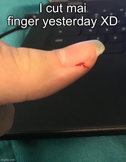 I cut mai finger yesterday XD | made w/ Imgflip meme maker