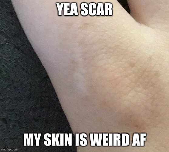 YEA SCAR MY SKIN IS WEIRD AF | made w/ Imgflip meme maker