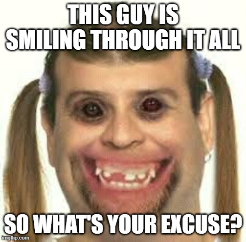 ugly person | THIS GUY IS SMILING THROUGH IT ALL; SO WHAT'S YOUR EXCUSE? | image tagged in ugly person | made w/ Imgflip meme maker