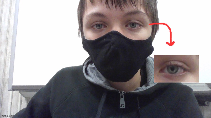 My eye bc why not. I took this a while ago btw | made w/ Imgflip meme maker