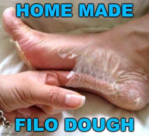 foot skin peel shedding | HOME MADE; FILO DOUGH | image tagged in foot skin peel shedding,gross,filo dough,foot fetish,fungus,skin peeling | made w/ Imgflip meme maker