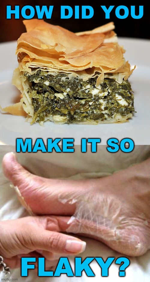 HOW DID YOU; MAKE IT SO; FLAKY? | image tagged in foot skin peel shedding,spinach,pie,crust,skin,gross | made w/ Imgflip meme maker