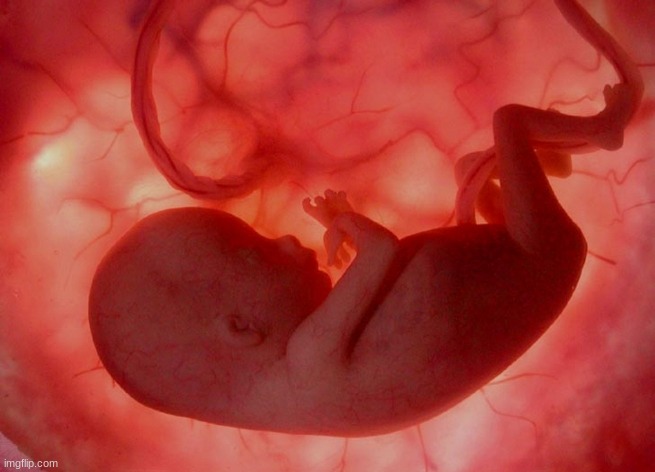 fetus | image tagged in fetus | made w/ Imgflip meme maker