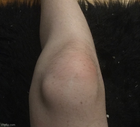 Kneecap reveal | image tagged in memes | made w/ Imgflip meme maker