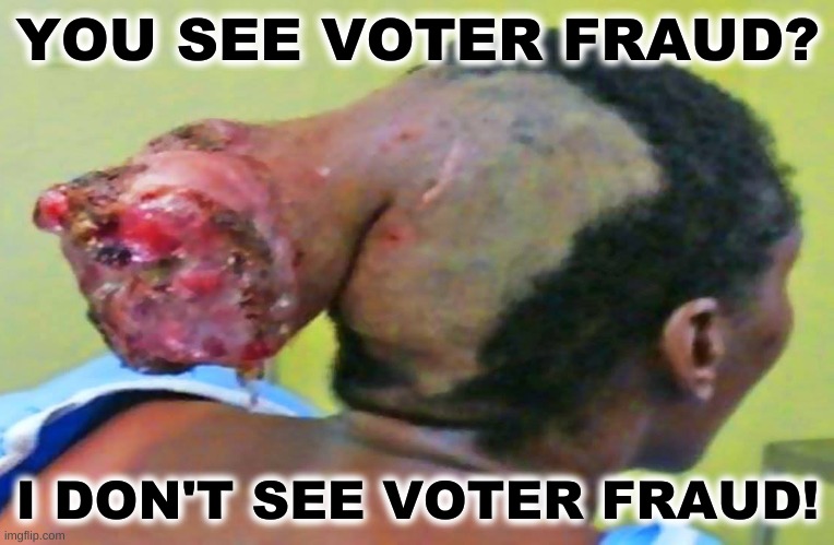 head tumor | YOU SEE VOTER FRAUD? I DON'T SEE VOTER FRAUD! | image tagged in head tumor,voter fraud,liberal hypocrisy,election 2020,expanding brain | made w/ Imgflip meme maker