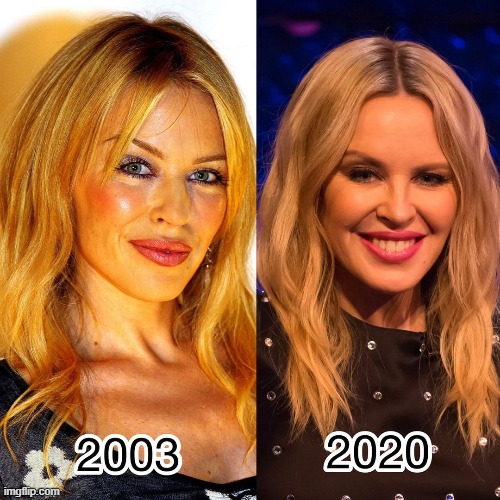 what can botox do 4 u? | image tagged in kylie 2003 2020 | made w/ Imgflip meme maker