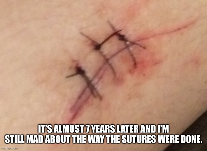 IT’S ALMOST 7 YEARS LATER AND I’M STILL MAD ABOUT THE WAY THE SUTURES WERE DONE. | made w/ Imgflip meme maker