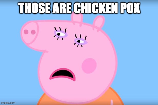 Mommy Pig | THOSE ARE CHICKEN POX | image tagged in mommy pig | made w/ Imgflip meme maker
