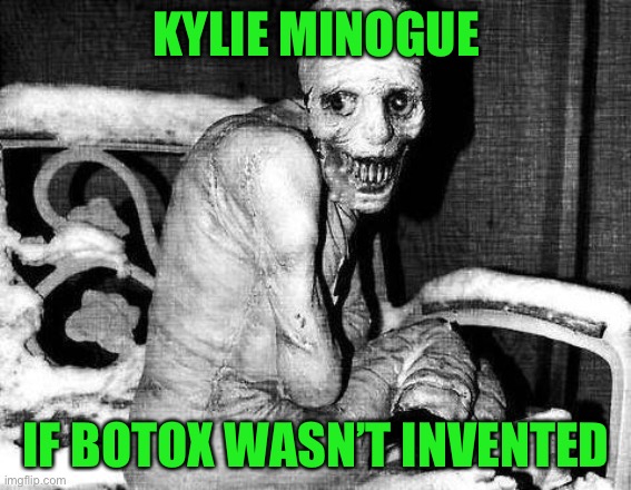 The Botox May be hideous, but be glad she has it on. | KYLIE MINOGUE; IF BOTOX WASN’T INVENTED | image tagged in russian sleep experiment | made w/ Imgflip meme maker