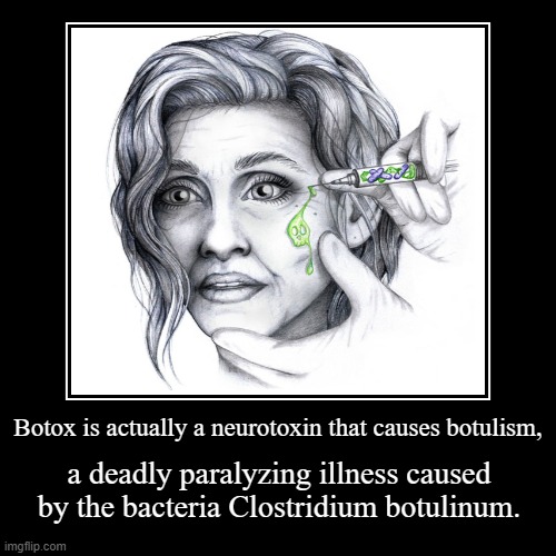 That's why when you see a person who is "aging well" but has one facial expression. They're muscles r literally paralyzed. | image tagged in funny,demotivationals | made w/ Imgflip demotivational maker