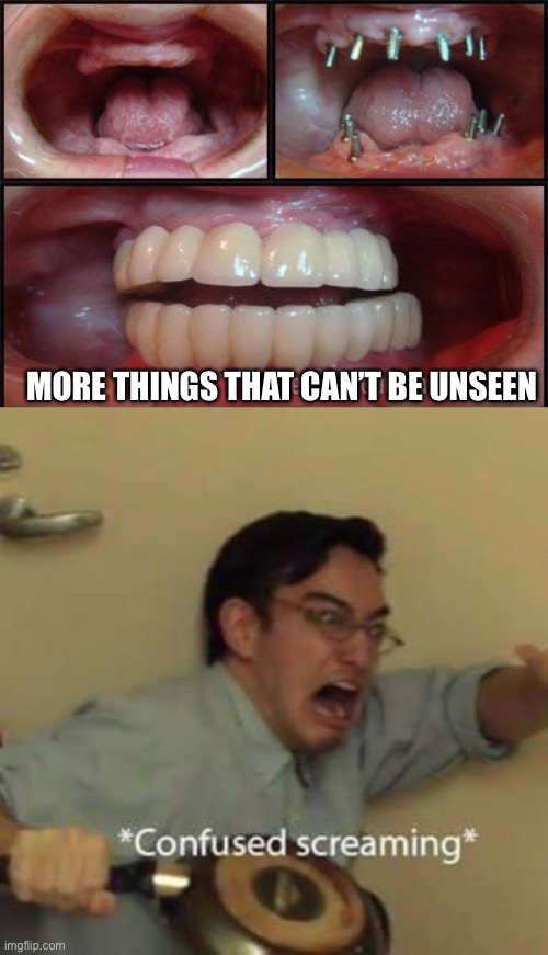 This is why you don’t brush, at anytime... ever...In your life... | MORE THINGS THAT CAN’T BE UNSEEN | image tagged in confused screaming | made w/ Imgflip meme maker