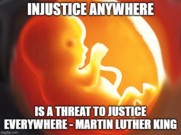 unborn child | INJUSTICE ANYWHERE; IS A THREAT TO JUSTICE EVERYWHERE - MARTIN LUTHER KING | image tagged in unborn child | made w/ Imgflip meme maker