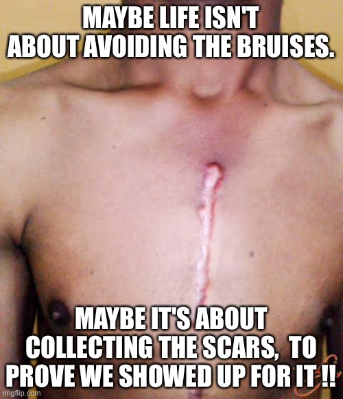 Life scars |  MAYBE LIFE ISN'T ABOUT AVOIDING THE BRUISES. MAYBE IT'S ABOUT COLLECTING THE SCARS,  TO PROVE WE SHOWED UP FOR IT !! | image tagged in scar,heart,surgery,battle,hospital | made w/ Imgflip meme maker