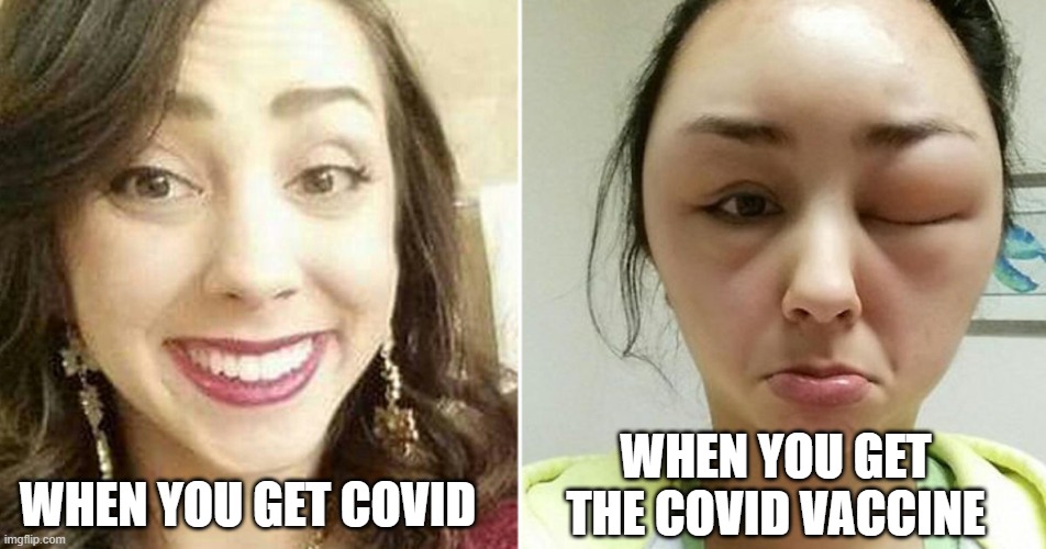 covid vs covid vaccine | WHEN YOU GET THE COVID VACCINE; WHEN YOU GET COVID | image tagged in before / after allergic reaction,FreeKarma4U | made w/ Imgflip meme maker