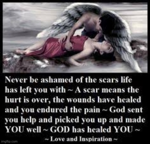 image tagged in scar,scars,angel,angels,god | made w/ Imgflip meme maker