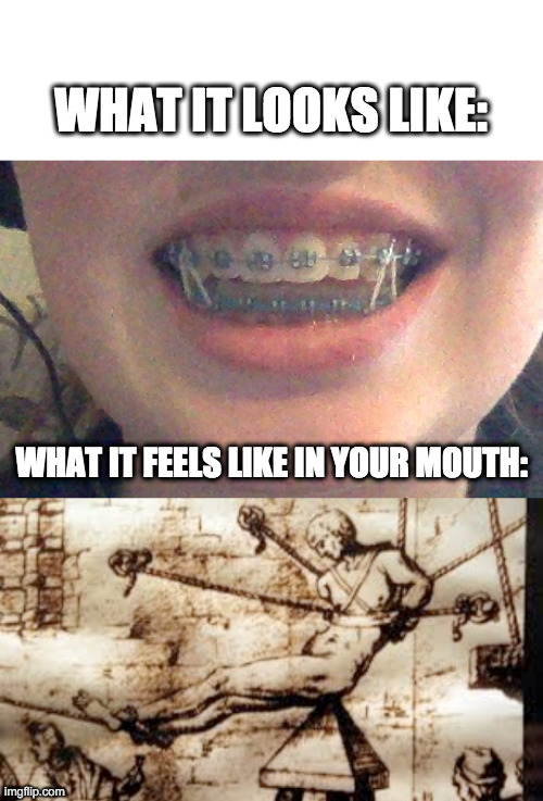 This is what happens when you get your braces tightened | WHAT IT LOOKS LIKE:; WHAT IT FEELS LIKE IN YOUR MOUTH: | image tagged in funny,braces | made w/ Imgflip meme maker