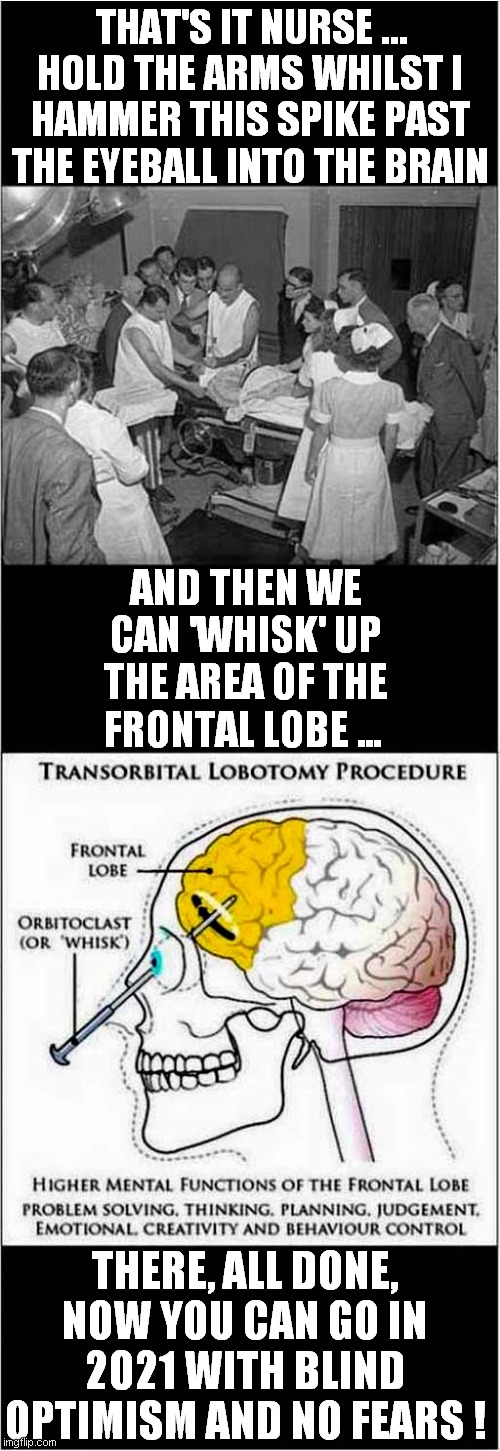 Lobotomy Solution To 2021 Fears | THAT'S IT NURSE … HOLD THE ARMS WHILST I HAMMER THIS SPIKE PAST THE EYEBALL INTO THE BRAIN; AND THEN WE CAN 'WHISK' UP THE AREA OF THE FRONTAL LOBE ... THERE, ALL DONE, NOW YOU CAN GO IN 2021 WITH BLIND OPTIMISM AND NO FEARS ! | image tagged in fun,lobotomy,2021,frontpage | made w/ Imgflip meme maker