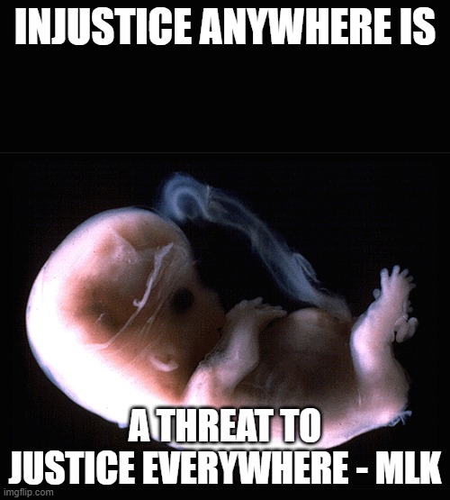 Fetus | INJUSTICE ANYWHERE IS; A THREAT TO JUSTICE EVERYWHERE - MLK | image tagged in fetus | made w/ Imgflip meme maker