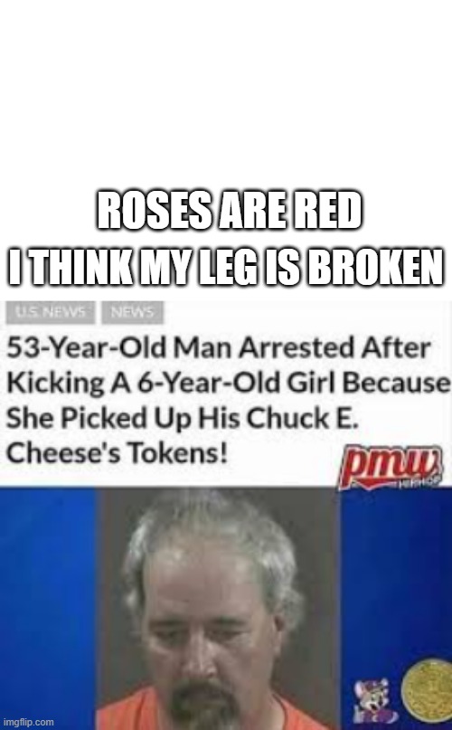 ROSES ARE RED; I THINK MY LEG IS BROKEN | image tagged in funny memes,oops | made w/ Imgflip meme maker