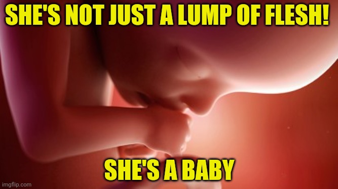 SHE'S NOT JUST A LUMP OF FLESH! SHE'S A BABY | made w/ Imgflip meme maker