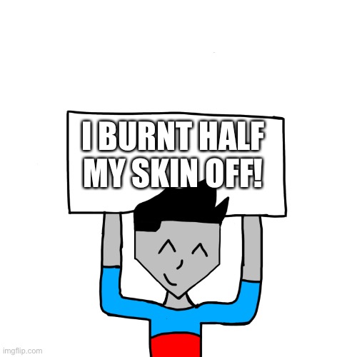 (Thomas is sayin this not me)(It has happened to me before tho) | I BURNT HALF MY SKIN OFF! | made w/ Imgflip meme maker