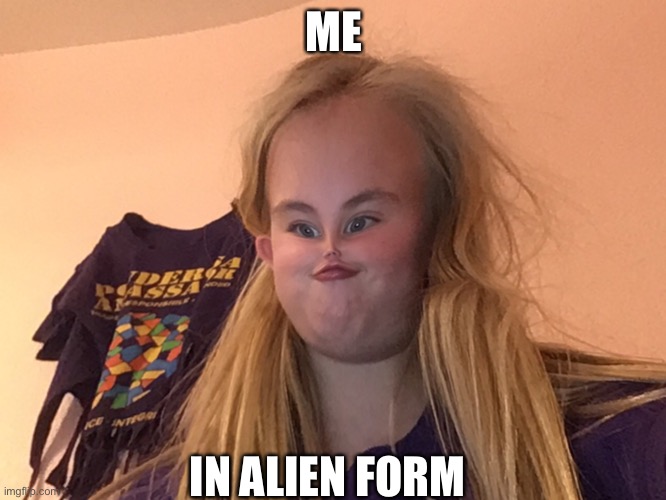 ME; IN ALIEN FORM | image tagged in aaaaand its gone | made w/ Imgflip meme maker