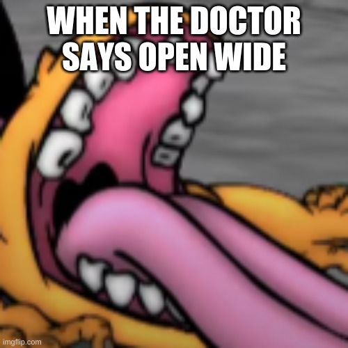 open wide |  WHEN THE DOCTOR SAYS OPEN WIDE | image tagged in funny,memes | made w/ Imgflip meme maker