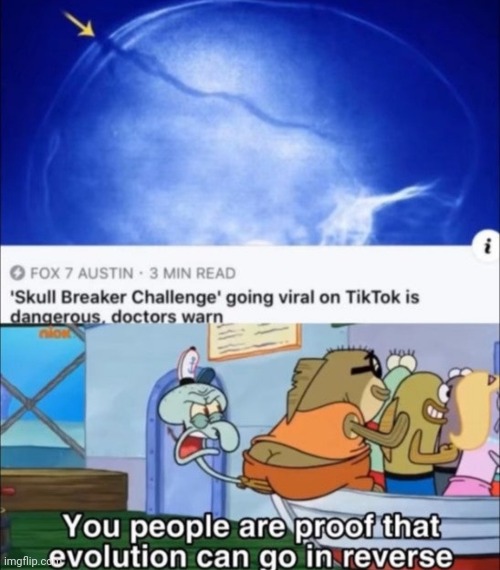 Yup that's how it works | image tagged in tik tok sucks | made w/ Imgflip meme maker
