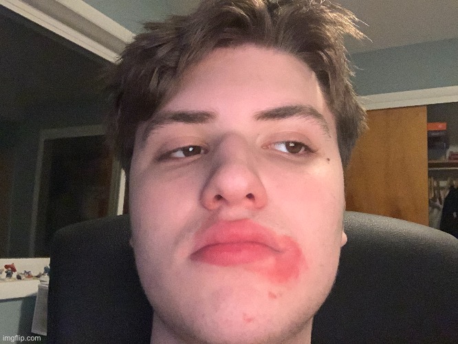 My face again and the red is from some chapstick I had | made w/ Imgflip meme maker