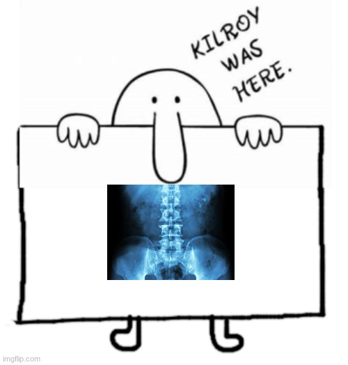 Kilroy sign | image tagged in kilroy sign,funny,clever,memes | made w/ Imgflip meme maker