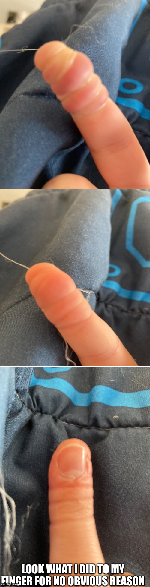 It actually hurt a ton | LOOK WHAT I DID TO MY FINGER FOR NO OBVIOUS REASON | made w/ Imgflip meme maker