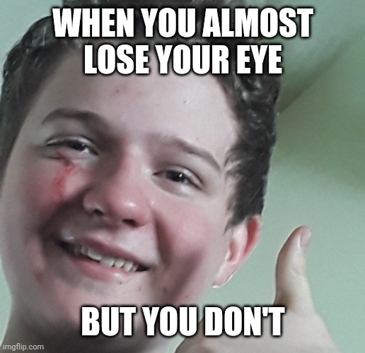 My younger brother almost lost his eye sledding | WHEN YOU ALMOST LOSE YOUR EYE; BUT YOU DON'T | image tagged in but you don't | made w/ Imgflip meme maker