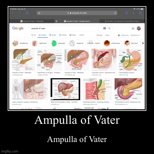 Ampulla of Vater | image tagged in meme | made w/ Imgflip demotivational maker