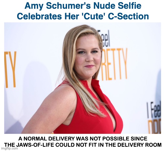Amy Schumer | image tagged in pregnancy | made w/ Imgflip meme maker