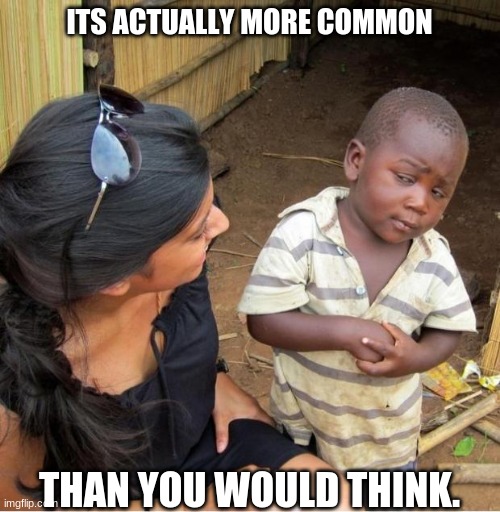 Skeptical third world kid | ITS ACTUALLY MORE COMMON THAN YOU WOULD THINK. | image tagged in skeptical third world kid | made w/ Imgflip meme maker