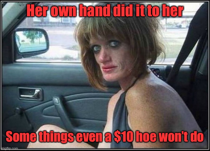 Ugly meth heroin addict Prostitute hoe in car | Her own hand did it to her Some things even a $10 hoe won’t do | image tagged in ugly meth heroin addict prostitute hoe in car | made w/ Imgflip meme maker