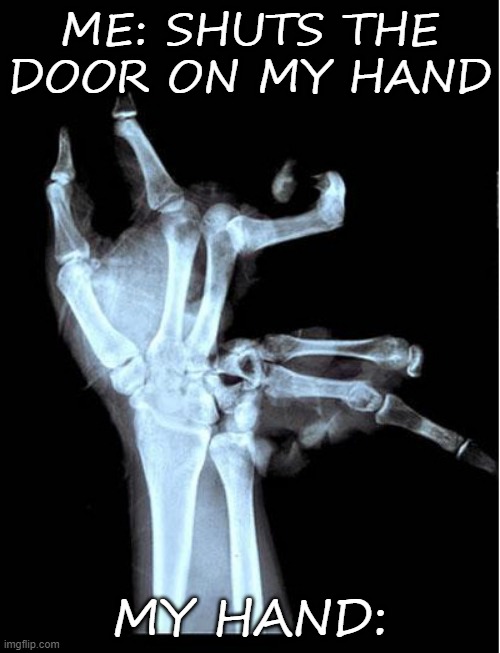 Door vs Hand | ME: SHUTS THE DOOR ON MY HAND; MY HAND: | image tagged in broken hand | made w/ Imgflip meme maker